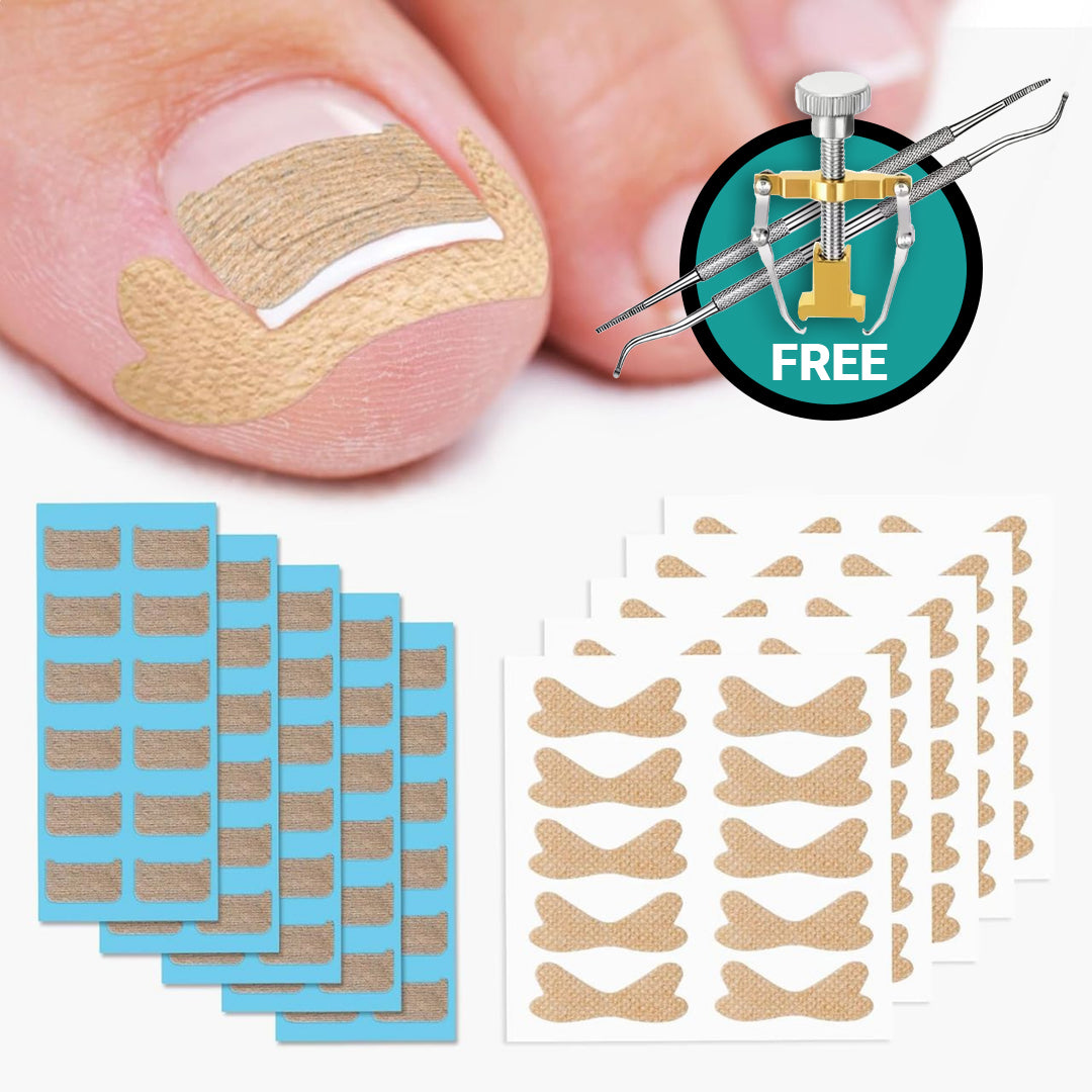 Nail Correction Strips