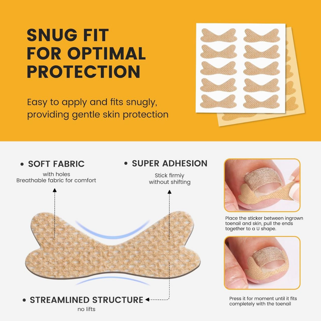 Nail Correction Strips
