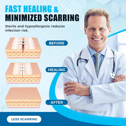 Wound Zippers
