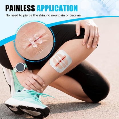 Wound Zippers