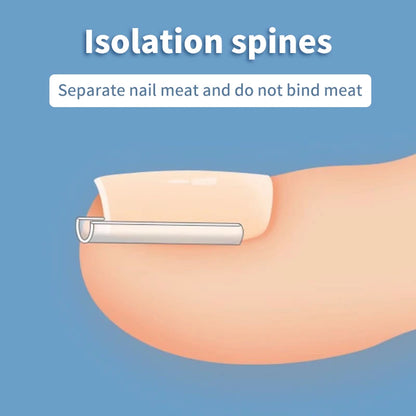 50 pcs Toenail Relief Strips