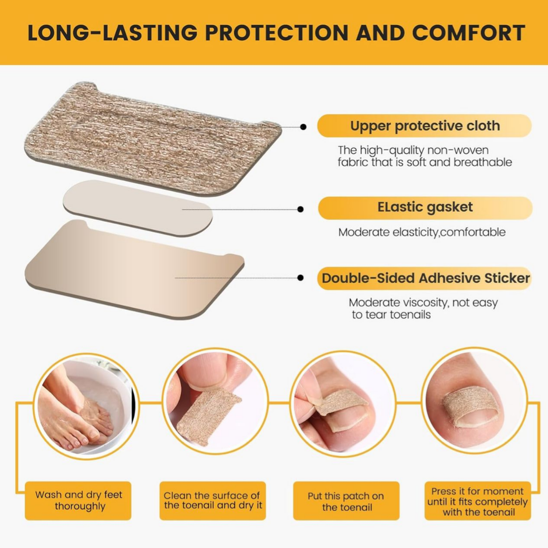 Nail Correction Strips